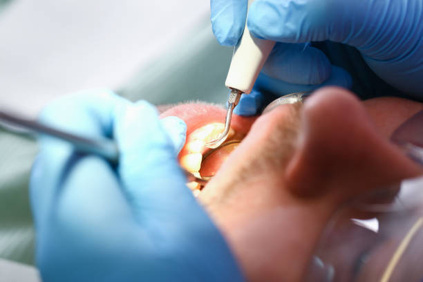 Best Weekend Emergency Dentist in Etowah, NC