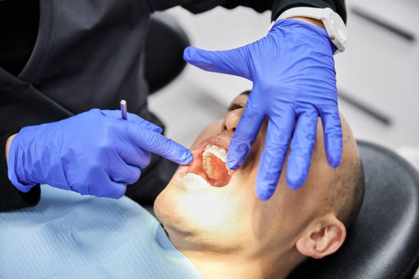 Best Emergency Tooth Extraction in Etowah, NC