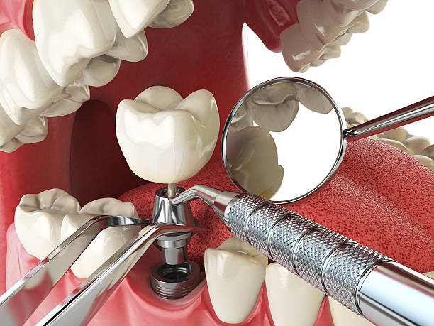 Best Pediatric Emergency Dentist in Etowah, NC