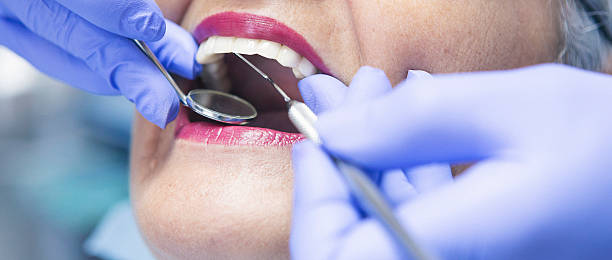 Best Emergency Tooth Extraction in Etowah, NC